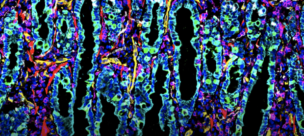 First Spatial Map of the Intestine at the Single-Cell Level